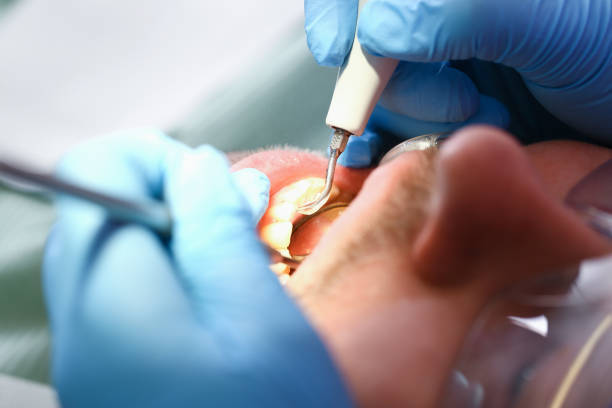Best Emergency Broken Tooth Repair in Lake Crystal, MN